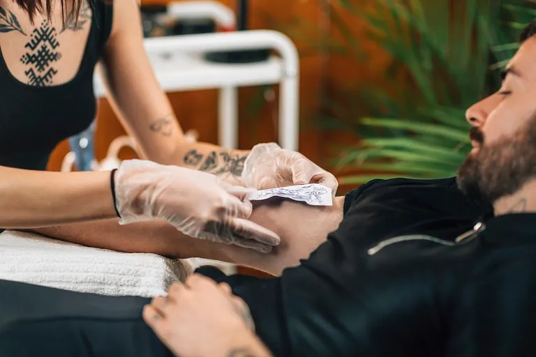 eliminacion tatuaje